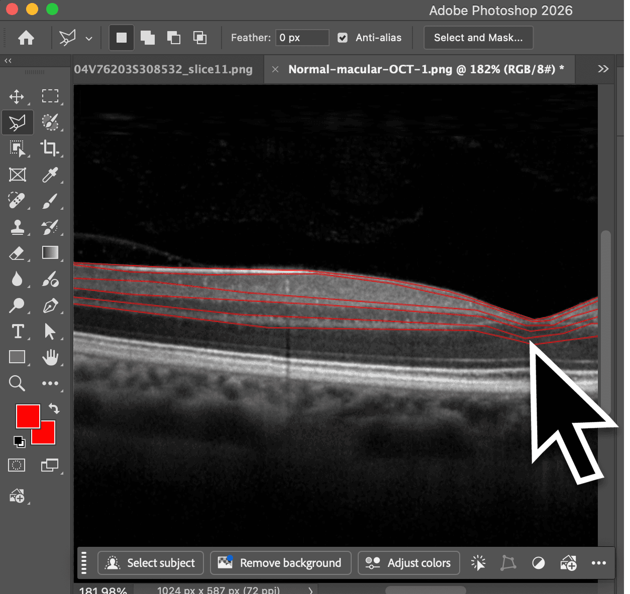Medical imaging annotation hero artwork